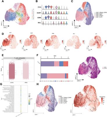 Documenting the immune response in patients with COVID-19-induced acute respiratory distress syndrome